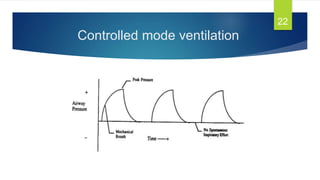 Controlled mode ventilation
22
 