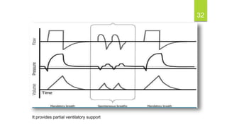32
It provides partial ventilatory support
 