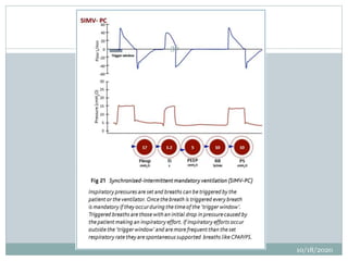 Mechanical ventilatory support | PPTX