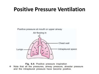 Positive Pressure Ventilation
 