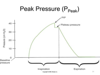 Peak Pressure (PPeak)
37
 