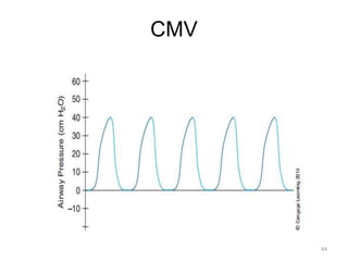 CMV
44
 