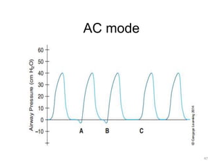 AC mode
47
 
