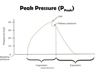 37
Peak Pressure (PPeak)
 