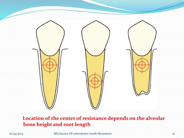 Mechanics of Orthodontic tooth movement | PPTX | Dental Health ...