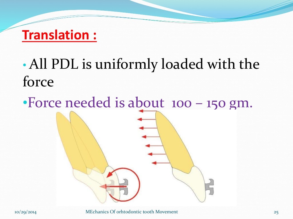 Mechanics of Orthodontic tooth movement