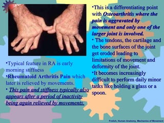 Frolich, Human Anatomy, Mechanics of Movement <ul><li>Typical feature in RA is early morning stiffness  </li></ul><ul><li>...