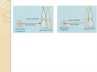 Teeth Mechanic mechanicsoforthodontictoothmovement-200523142932.pptx