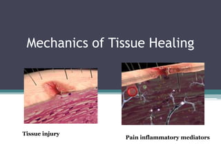 Mechanics of Tissue Healing Tissue injury  Pain inflammatory mediators 