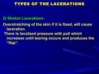 Mechan injuries 17-18сжат-1;zsmu | PPT