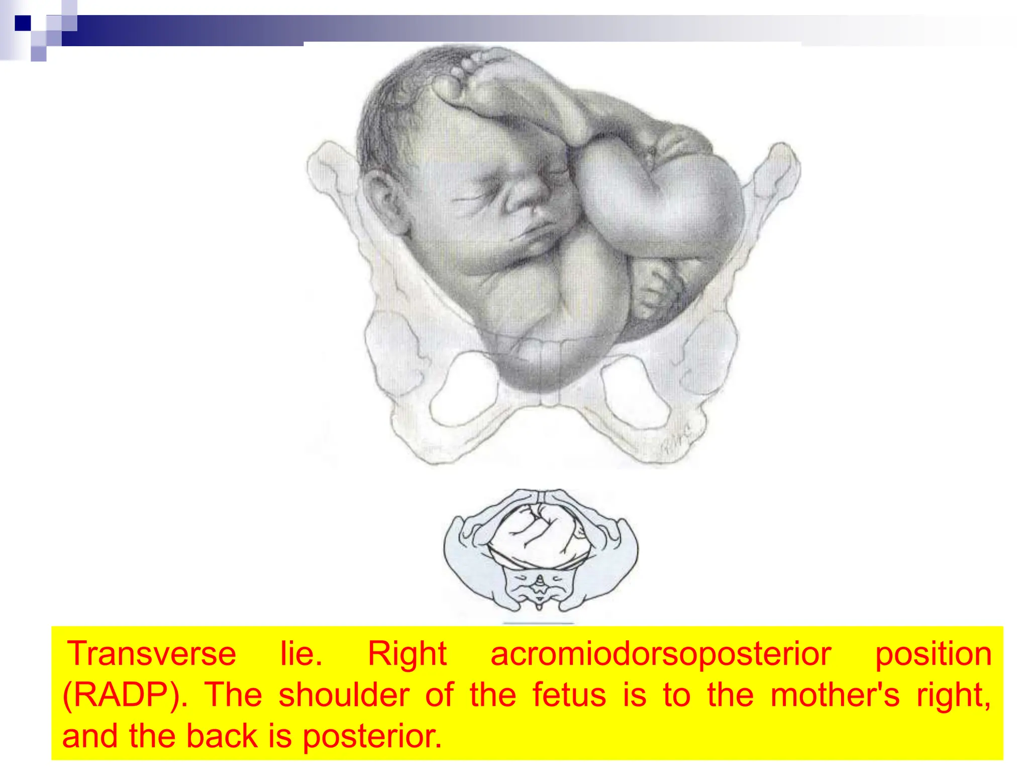 mechanism-of-labour.ppt OBSTETRICS and gynaecologist | PPT