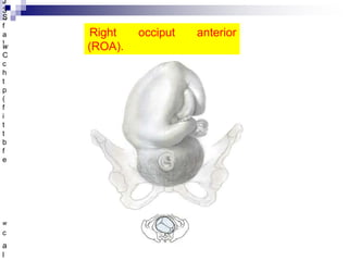 mechanism-of-labour.ppt OBSTETRICS and gynaecologist | PPT