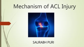 Mechanism of ACL Injury
SAURABH PURI
 
