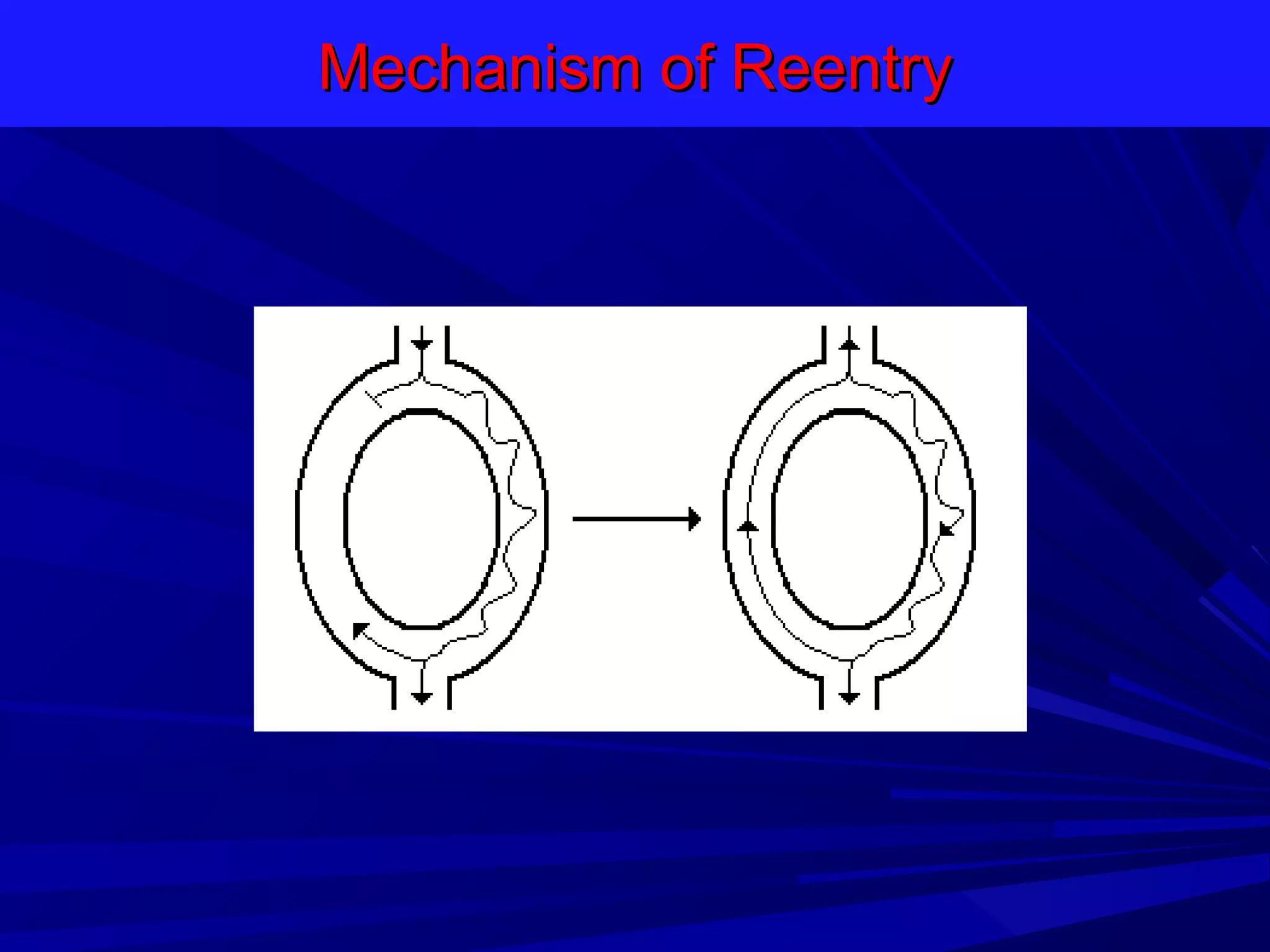 Mechanism of Reentry

 