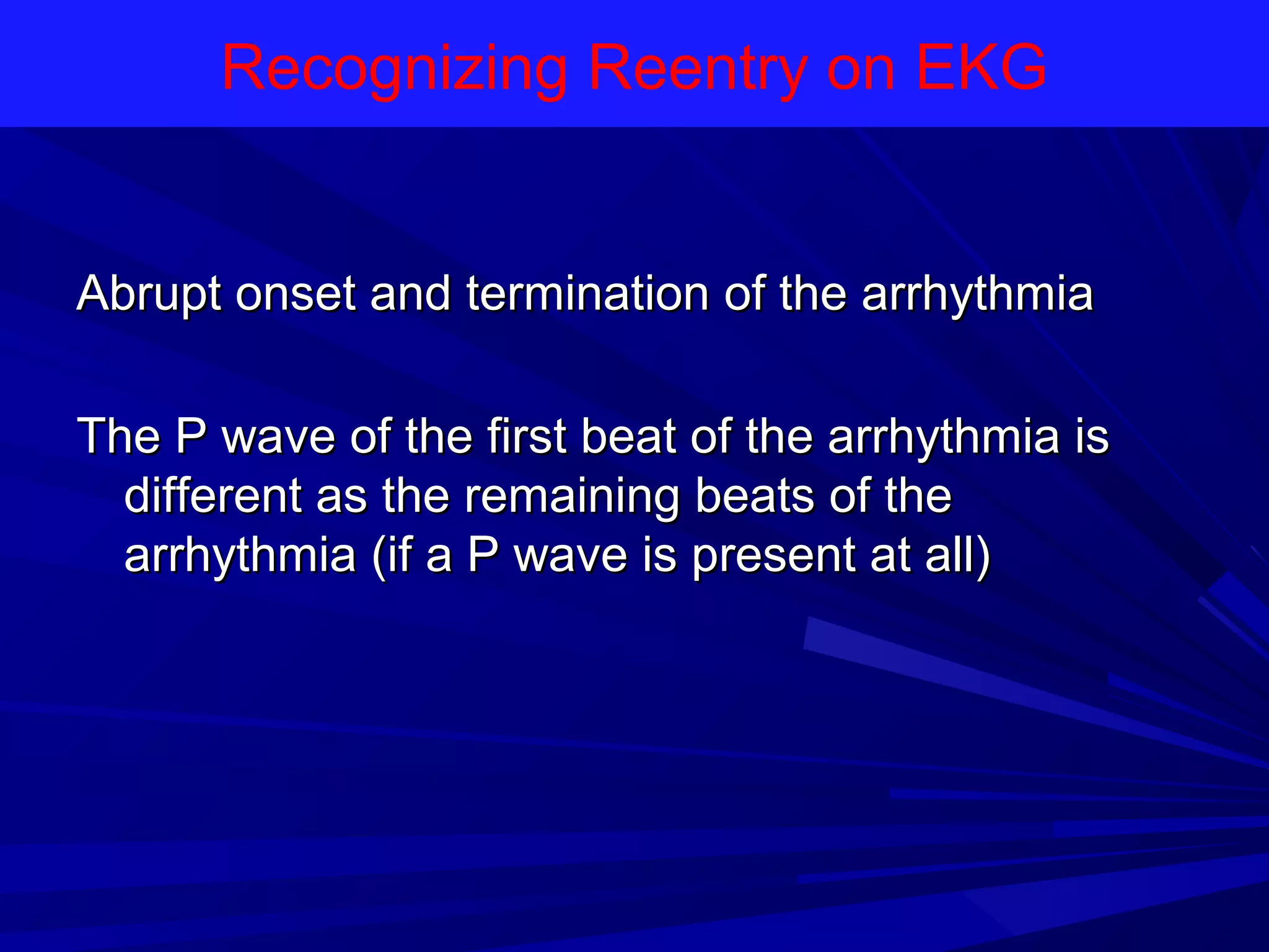 Recognizing Reentry on EKG

Abrupt onset and termination of the arrhythmia
The P wave of the first beat of the arrhythmia is
different as the remaining beats of the
arrhythmia (if a P wave is present at all)

 