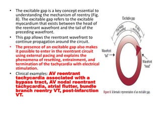 Mechanism of arrythmias | PPTX