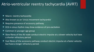 Comprehensive Mechanisms and EKG Characteristics of Cardiac Arrhythmias ...