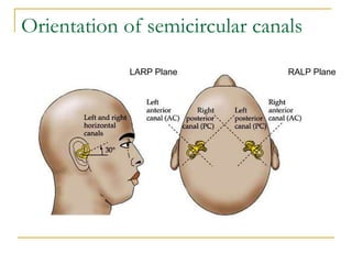Orientation of semicircular canals
RALP PlaneLARP Plane
 