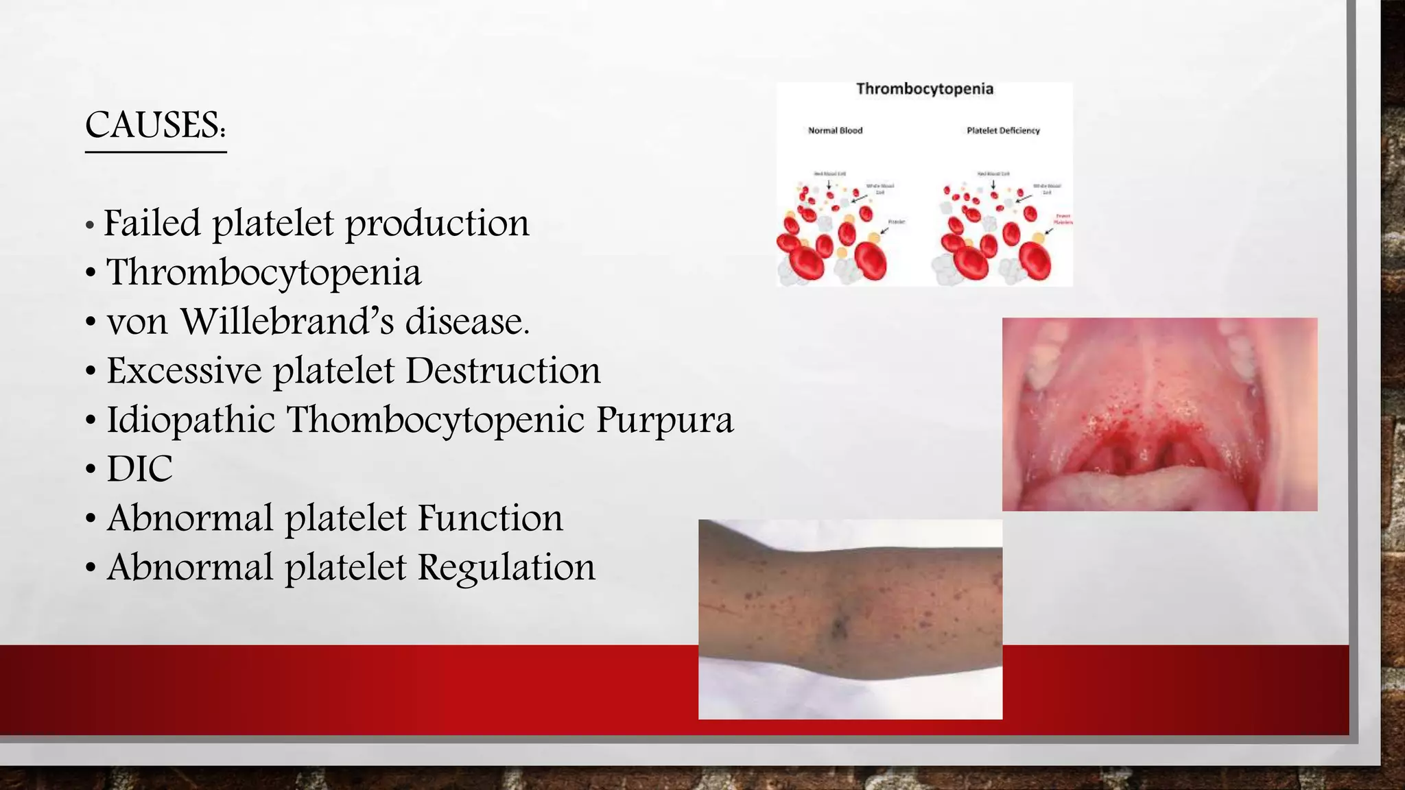 Dyscariasis Mechanism of blood clotting and blood dyscrasias | PPTX