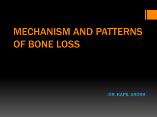 MECHANISM AND PATTERNS
OF BONE LOSS
-DR. KAPIL ARORA
 