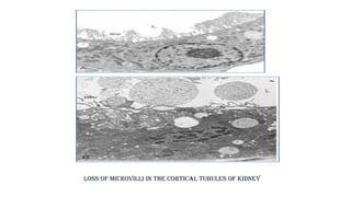 mechanism of cell injury.pptx important when cell inury occure it is ...