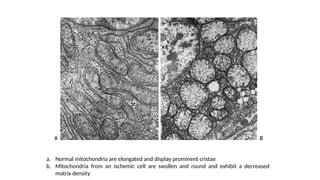 mechanism of cell injury.pptx important when cell inury occure it is ...