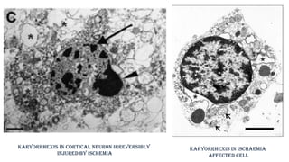 mechanism of cell injury.pptx important when cell inury occure it is ...