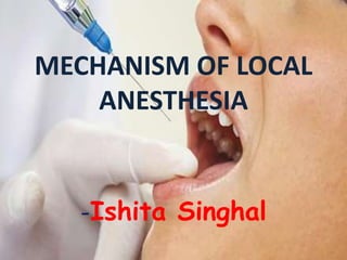 MECHANISM OF LOCAL
ANESTHESIA
-Ishita Singhal
 