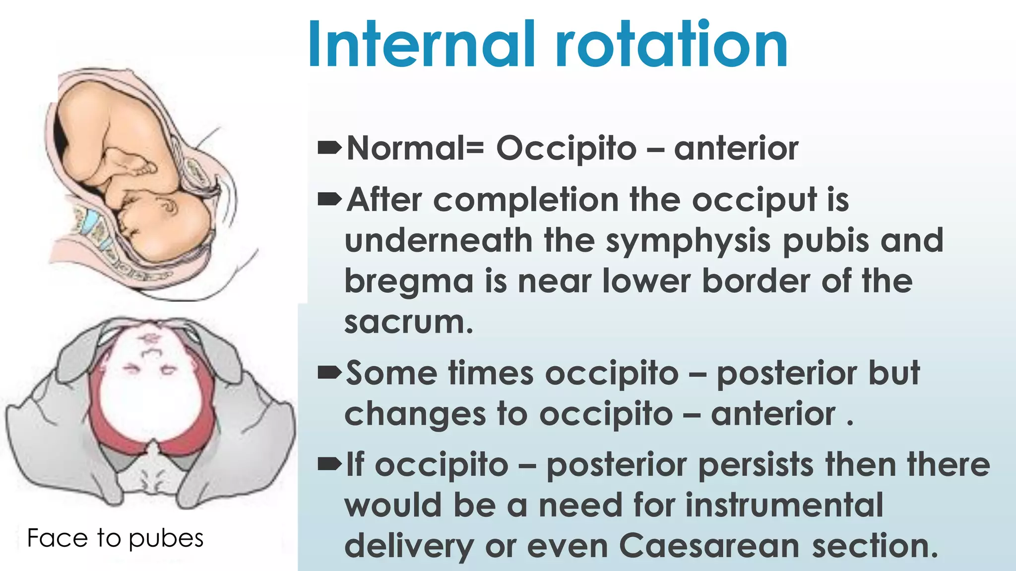 Internal rotation
Normal= Occipito – anterior
After completion the occiput is
underneath the symphysis pubis and
bregma is near lower border of the
sacrum.
Some times occipito – posterior but
changes to occipito – anterior .
If occipito – posterior persists then there
would be a need for instrumental
delivery or even Caesarean section.Face to pubes
 