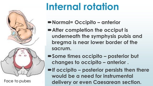 Mechanism of labor | PDF