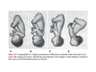 Mechanism of labor | PPSX