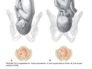 Mechanism of labor | PPSX
