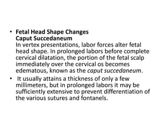 Mechanism of labor | PPSX