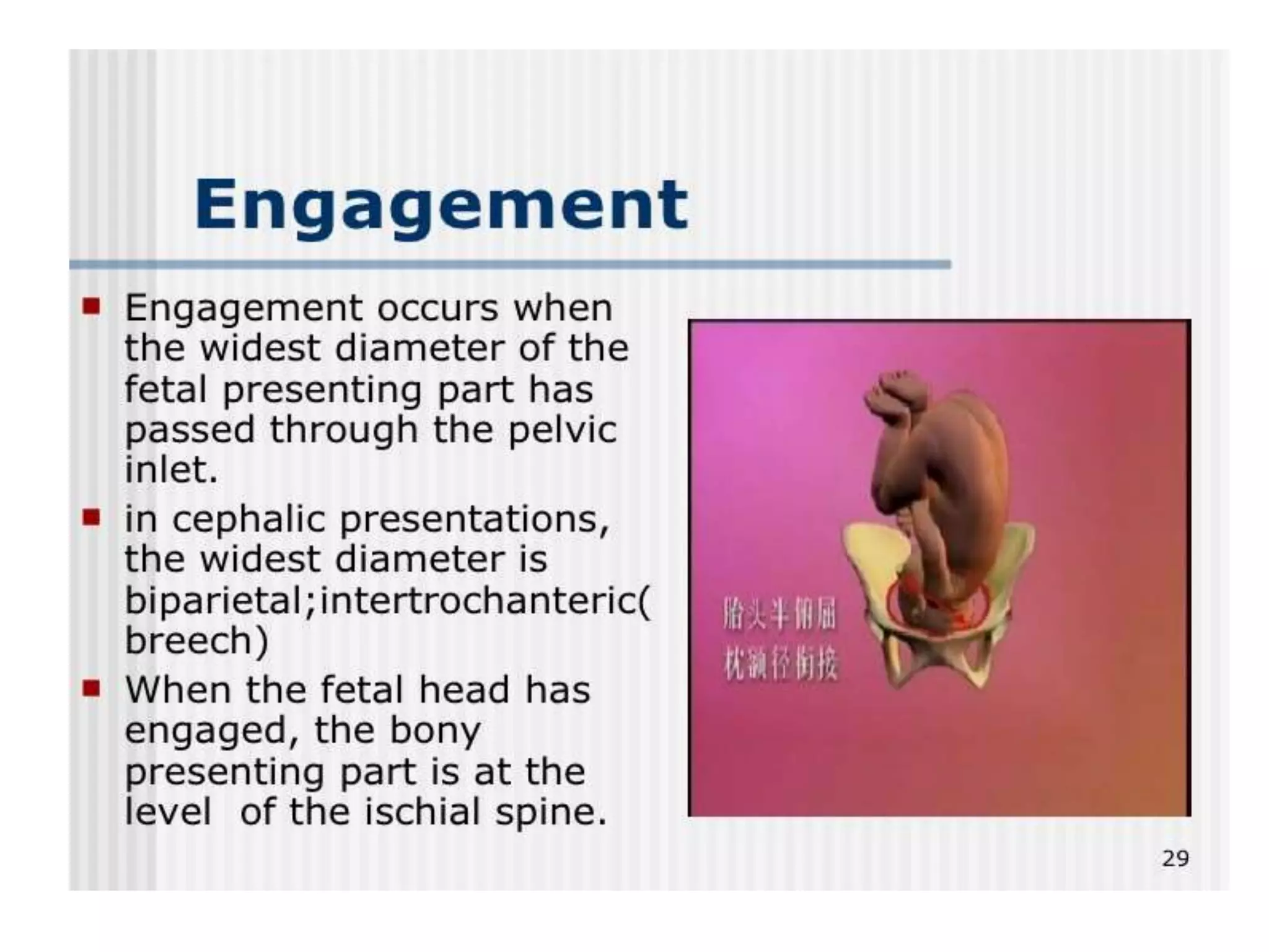 Mechanism of labour ppt