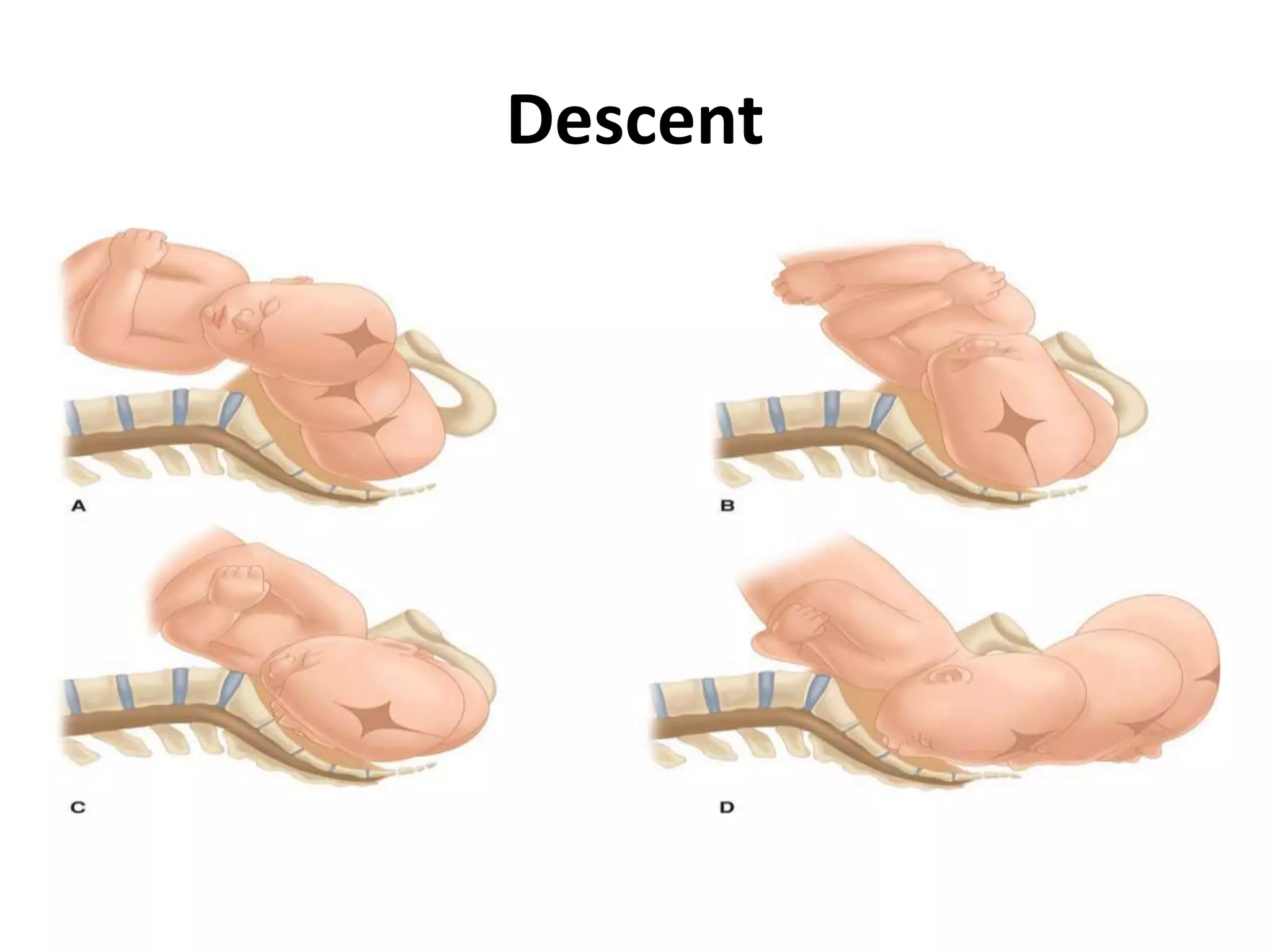 Mechanism of labour pptx