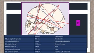 Deflexed mechanism of labour important event .pptx