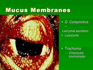 Mucus Membranes D. Conjunctiva – Lacrymal secretion Lysozyme Trachoma Chlamydia trachomatis 