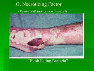 G. Necrotizing Factor - Causes death (necrosis) to tissue cells “ Flesh Eating Bacteria” 