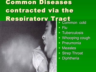 Common Diseases contracted via the Respiratory Tract Common  cold Flu Tuberculosis Whooping cough Pneumonia Measles Strep Throat Diphtheria 