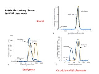 Emphysema Distribution Comprehensive Mechanisms of Respiratory Failure: Pathophysiology and ...