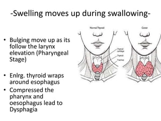 Mechanism of swallowing | PPTX