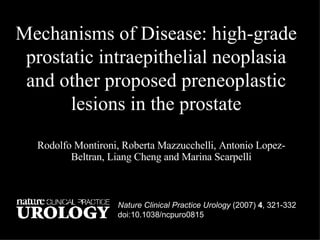 Mechanisms of Disease: high-grade prostatic intraepithelial neoplasia and other proposed preneoplastic lesions in the prostate Rodolfo Montironi, Roberta Mazzucchelli, Antonio Lopez-Beltran, Liang Cheng and Marina Scarpelli Nature Clinical Practice Urology (2007)  4 , 321-332 doi:10.1038/ncpuro0815  Nature Clinical Practice Urology (2007)  4 , 321-332 doi:10.1038/ncpuro0815  Nature Clinical Practice Urology  (2007)  4 , 321-332 doi:10.1038/ncpuro0815  