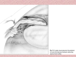 Mechanisms of angle closure glaucoma | PPTX