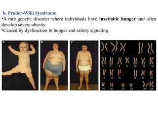 Hunger Dysfunction Mechanisms of Hunger and Energy Cost of Macronutrients.pptx