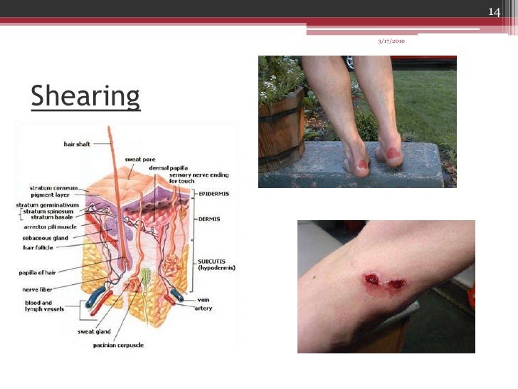 Mechanisms Of Injuries2010show1
