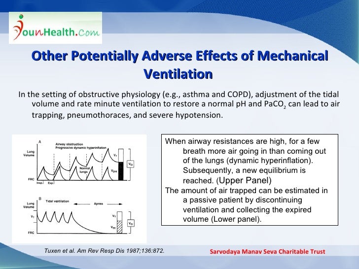 Mechenical ventilation