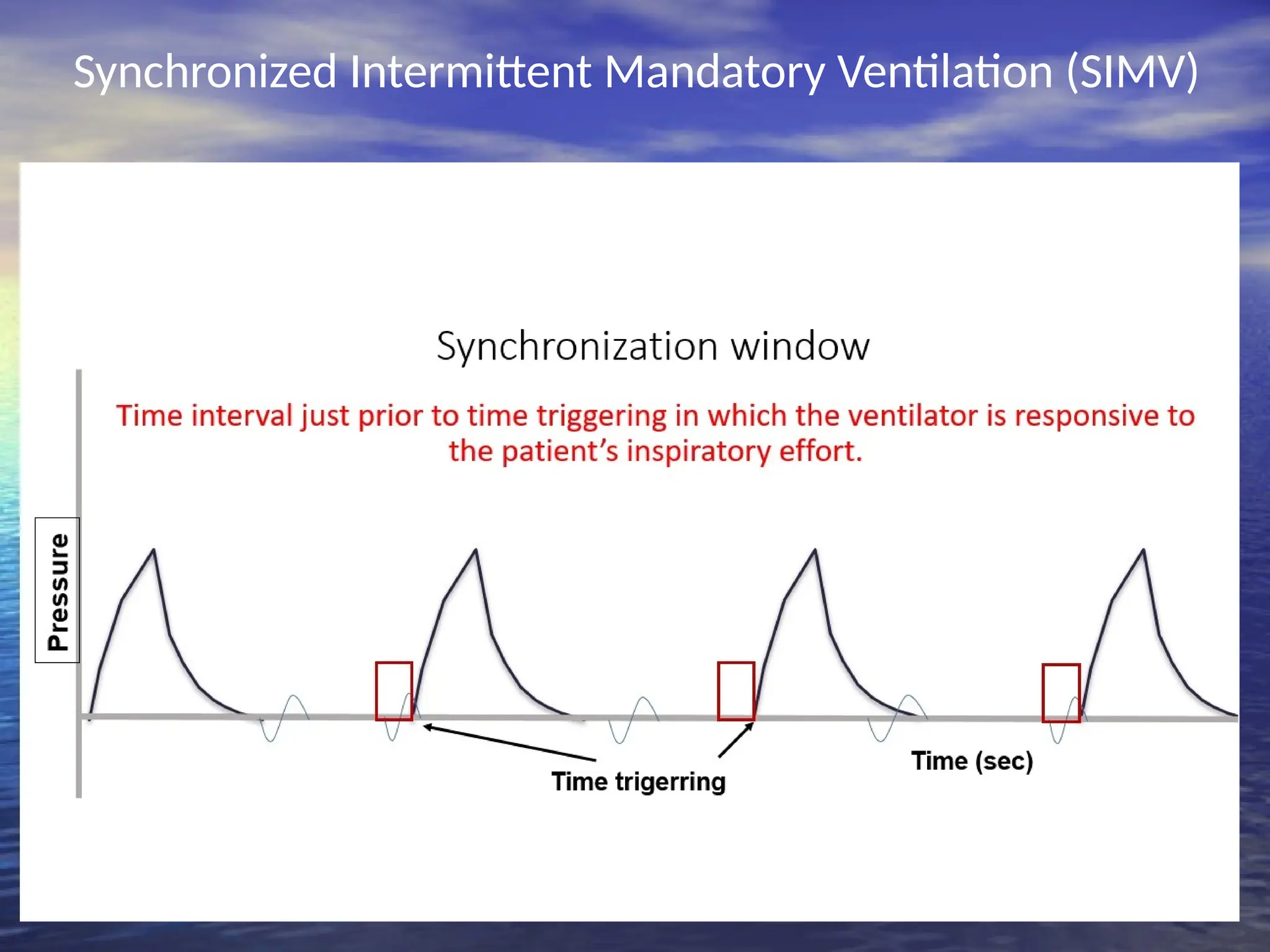 Synchronized Intermittent Mandatory Ventilation (SIMV)
 