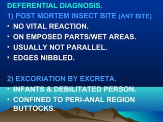 DEFERENTIAL DIAGNOSIS. 
1) POST MORTEM INSECT BITE (ANT BITE) 
• NO VITAL REACTION. 
• ON EMPOSED PARTS/WET AREAS. 
• USUALLY NOT PARALLEL. 
• EDGES NIBBLED. 
2) EXCORIATION BY EXCRETA. 
• INFANTS & DEBILITATED PERSON. 
• CONFINED TO PERI-ANAL REGION 
BUTTOCKS. 
 