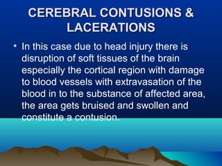 CCEERREEBBRRAALL CCOONNTTUUSSIIOONNSS && 
LLAACCEERRAATTIIOONNSS 
• In this case due to head injury there is 
disruption of soft tissues of the brain 
especially the cortical region with damage 
to blood vessels with extravasation of the 
blood in to the substance of affected area, 
the area gets bruised and swollen and 
constitute a contusion. 
 