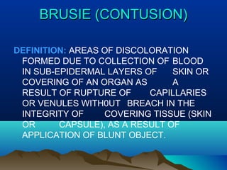 BBRRUUSSIIEE ((CCOONNTTUUSSIIOONN)) 
DEFINITION: AREAS OF DISCOLORATION 
FORMED DUE TO COLLECTION OF BLOOD 
IN SUB-EPIDERMAL LAYERS OF SKIN OR 
COVERING OF AN ORGAN AS A 
RESULT OF RUPTURE OF CAPILLARIES 
OR VENULES WITH0UT BREACH IN THE 
INTEGRITY OF COVERING TISSUE (SKIN 
OR CAPSULE), AS A RESULT OF 
APPLICATION OF BLUNT OBJECT. 
 